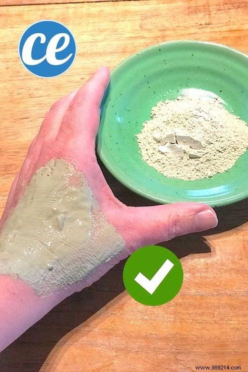 5 Time-Tested Grandmother s Remedies to Relieve Chigger Bite Itching