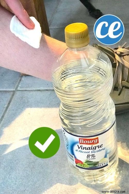 5 Time-Tested Grandmother s Remedies to Relieve Chigger Bite Itching