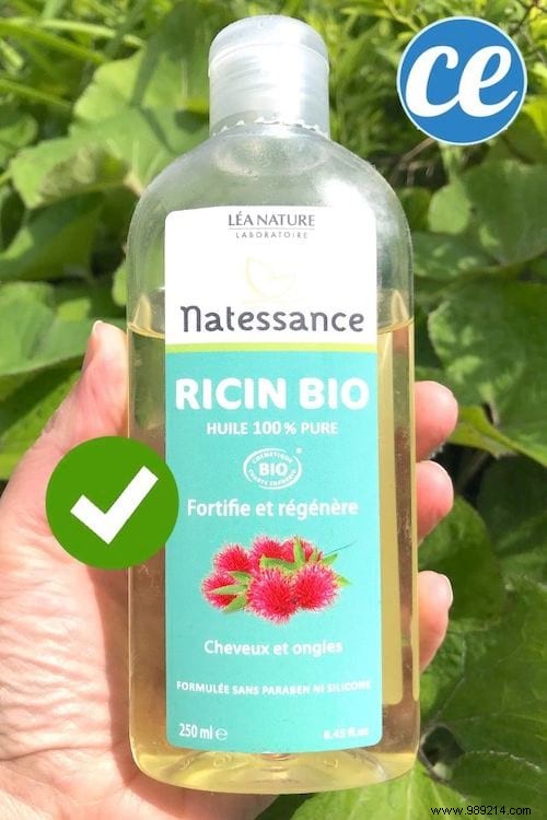 5 Time-Tested Grandmother s Remedies to Relieve Chigger Bite Itching