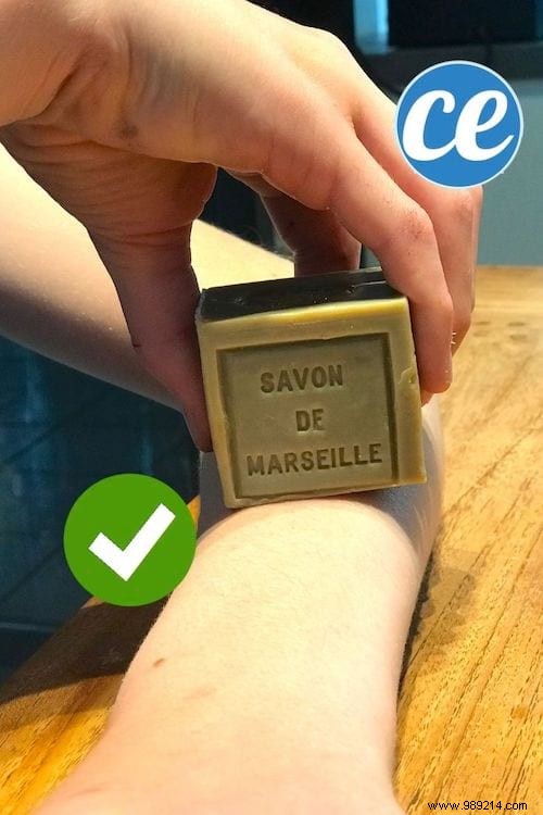 5 Time-Tested Grandmother s Remedies to Relieve Chigger Bite Itching