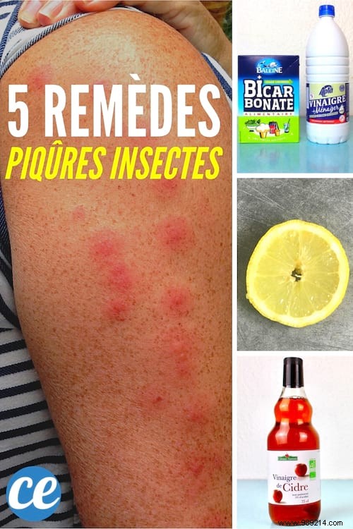 5 Time-Tested Grandma s Remedies to Relieve Insect Bites Naturally