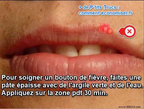 Banish Cold Sores in 30 Minutes: My Proven Green Clay Remedy