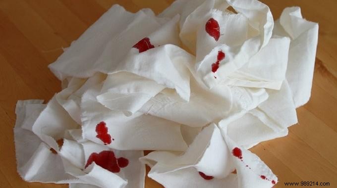 How to Remove Blood Stains from Fabric: Proven, Easy Steps