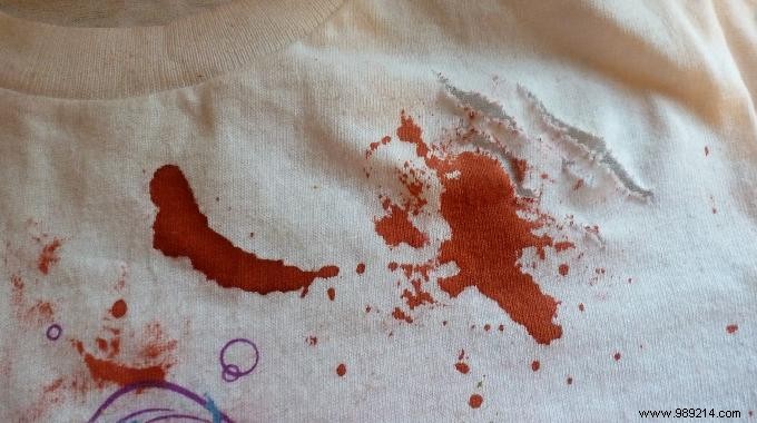 Proven Grandmother s Trick: Remove Stubborn Dried Blood Stains with Soda Crystals