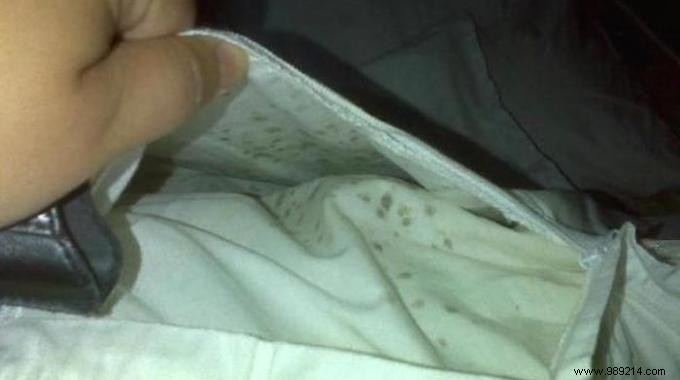 How to Remove Mildew Stains from Fabric: Proven Baking Soda and Vinegar Method