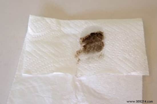 Proven Trick: Effortlessly Clean Stubborn Cooking Oil Splatters from Kitchen Surfaces