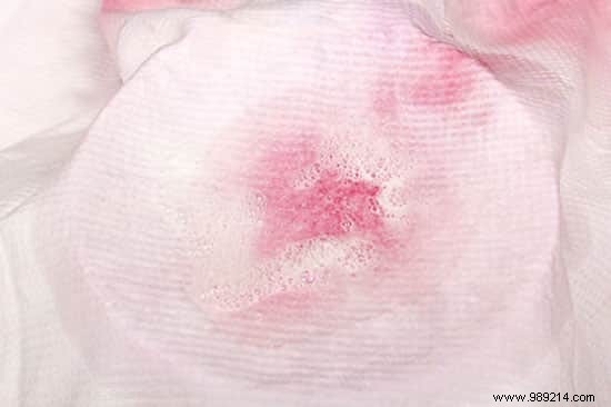 Erase Red Wine Stains Effortlessly: The Proven Hydrogen Peroxide and Dish Soap Method