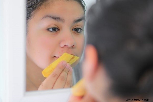 13 Proven Uses for Banana Peels: Eco-Friendly Hacks for Gardening, Cleaning, and Health