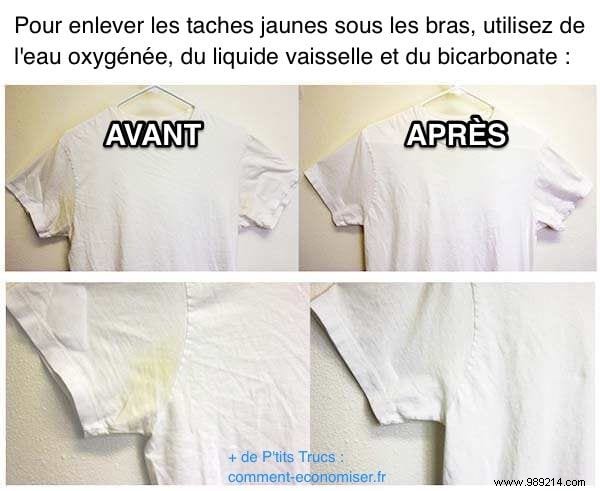 16 Time-Tested Grandmother s Tricks to Whiten Clothes Naturally—Without Bleach