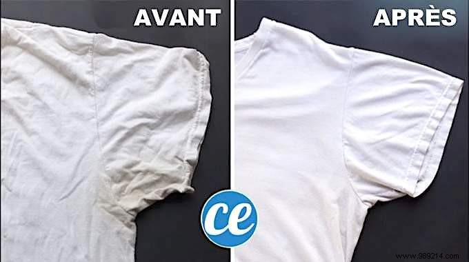 Proven Baking Soda Trick to Eliminate Yellow Sweat Stains from Clothes