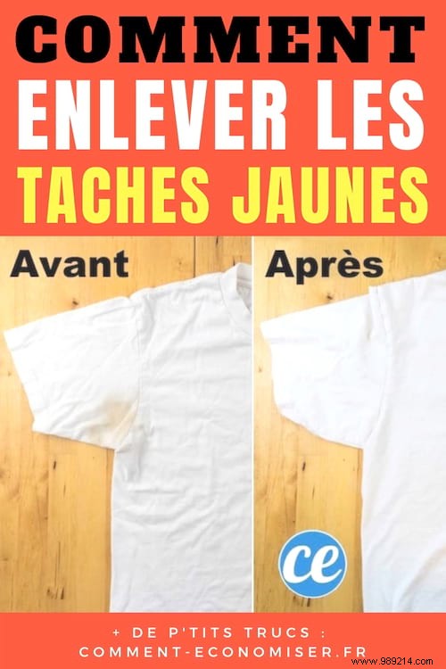 Proven Baking Soda Trick to Eliminate Yellow Sweat Stains from Clothes