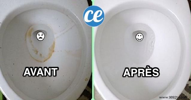 Baking Soda and White Vinegar: The Ultimate Natural Toilet Bowl Cleaner