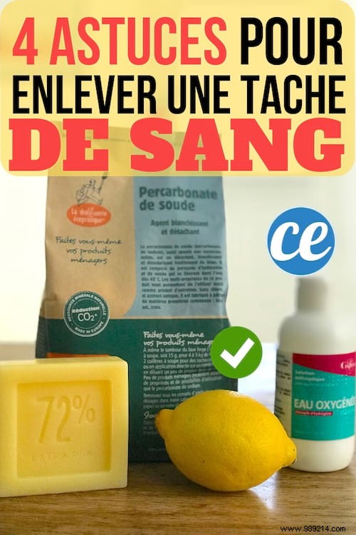 4 Proven Home Remedies to Remove Blood Stains from Fabric Quickly