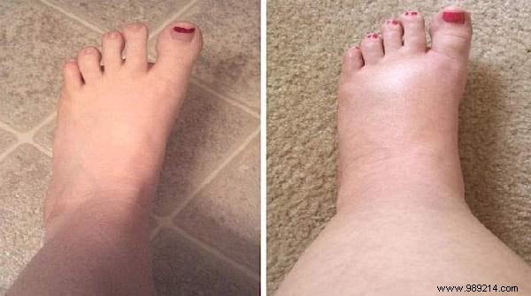 Top 10 Practical Life Hacks of the Week: August 24, 2019 – Save Money, Fix Drains & More