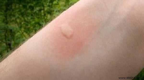 Top 10 Expert Home and Garden Tips: Week of July 20, 2019