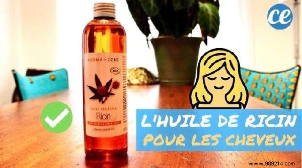 Top 10 Weekly Tips: Common French Mistakes, Castor Oil Hair Benefits, Shiny Hair Secrets & More