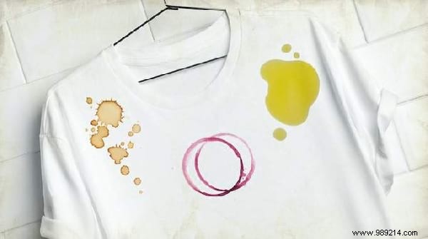 Top 10 Weekly Tips: Common French Mistakes, Castor Oil Hair Benefits, Shiny Hair Secrets & More