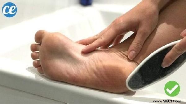 Top 10 Weekly Tips: Common French Mistakes, Castor Oil Hair Benefits, Shiny Hair Secrets & More