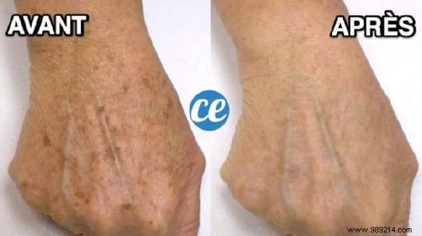 Top 10 Proven Life Hacks: Natural Anti-Hair Loss Shampoo, Dark Spot Remedies, and Tights Recycling Ideas