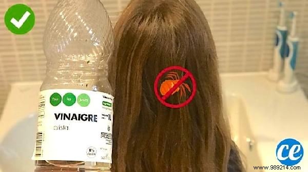 Top 10 Proven Life Hacks: Natural Anti-Hair Loss Shampoo, Dark Spot Remedies, and Tights Recycling Ideas