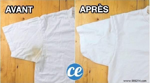 Top 10 Proven Life Hacks: Natural Anti-Hair Loss Shampoo, Dark Spot Remedies, and Tights Recycling Ideas