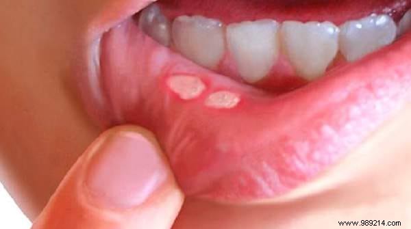 41 Proven Uses of Magnesium Chloride: Natural Remedies for Everyday Health