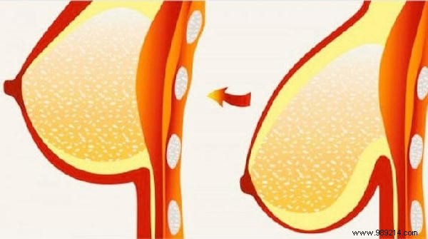 3 Proven Natural Tips to Firm and Lift Your Breasts After 50, Weight Loss, or Pregnancy