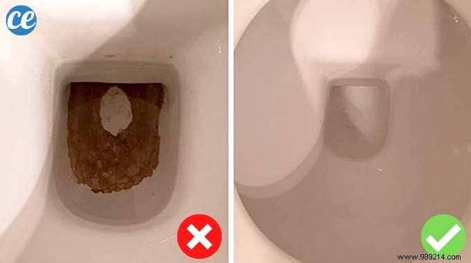 Effortless Natural Solution: Remove Black Stains from Your Toilet Bowl with Citric Acid