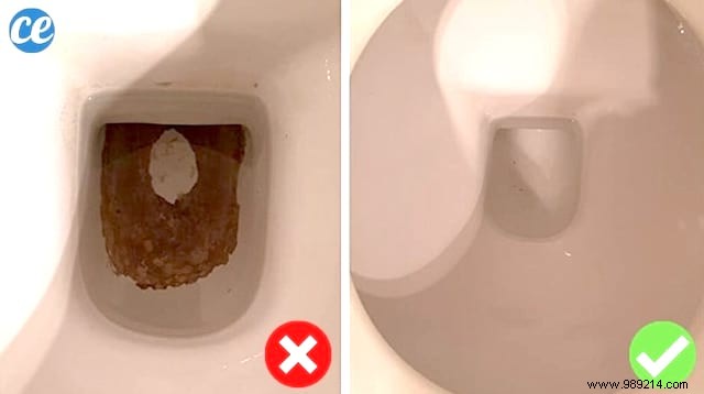 Effortless Natural Solution: Remove Black Stains from Your Toilet Bowl with Citric Acid