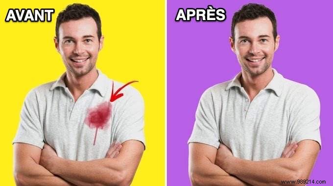 7 Proven Ways to Remove Beet Stains Without Rubbing