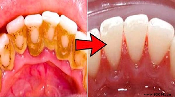 Top 10 Most Shared Cleaning and Household Hacks of 2021: Tips Loved by Millions