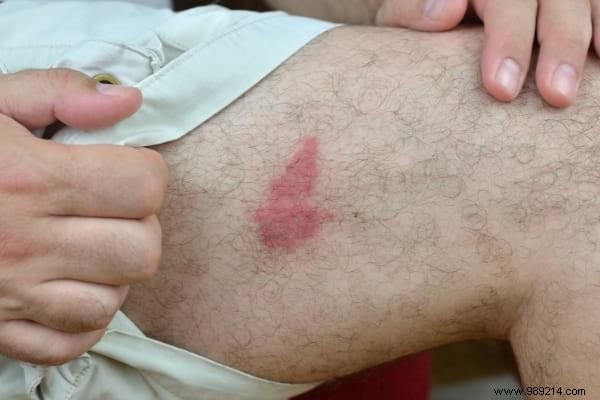 24 Proven Ice Cube Hacks for Home, Beauty, and Kitchen: Expert Household Tips