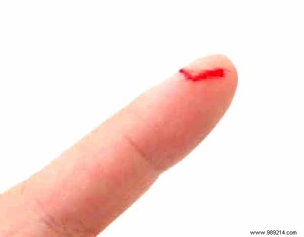 51 Proven Hydrogen Peroxide Uses for Health, Beauty, Cleaning, and Home Care