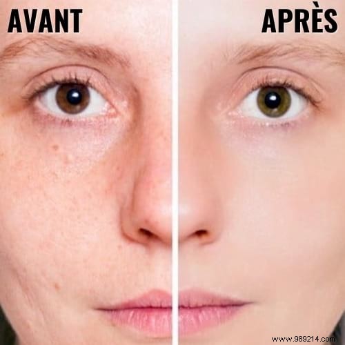 51 Proven Hydrogen Peroxide Uses for Health, Beauty, Cleaning, and Home Care