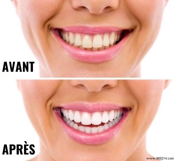 51 Proven Hydrogen Peroxide Uses for Health, Beauty, Cleaning, and Home Care