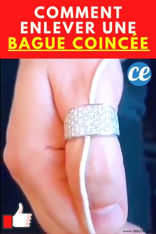 Jeweler s Proven Thread Trick: Remove a Stuck Ring Effortlessly