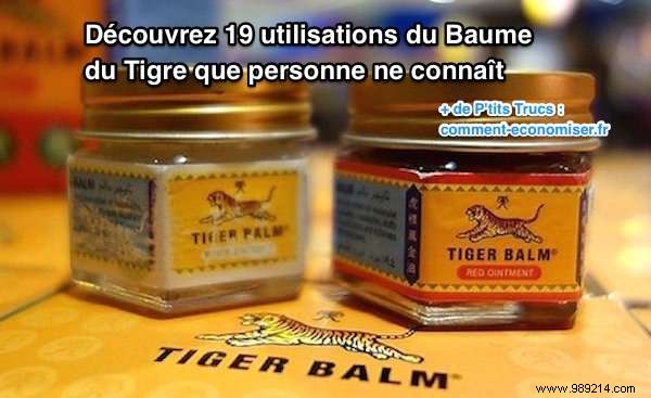 19 Lesser-Known Tiger Balm Uses: Time-Tested Remedies for Everyday Ailments