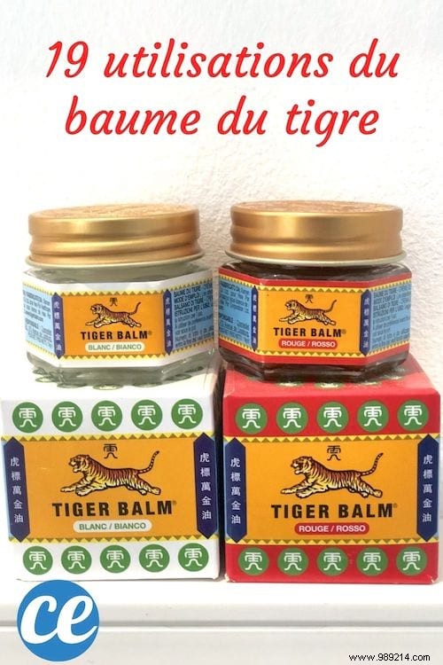 19 Lesser-Known Tiger Balm Uses: Time-Tested Remedies for Everyday Ailments