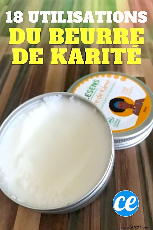 18 Proven Shea Butter Benefits for Skin, Hair, and Everyday Wellness