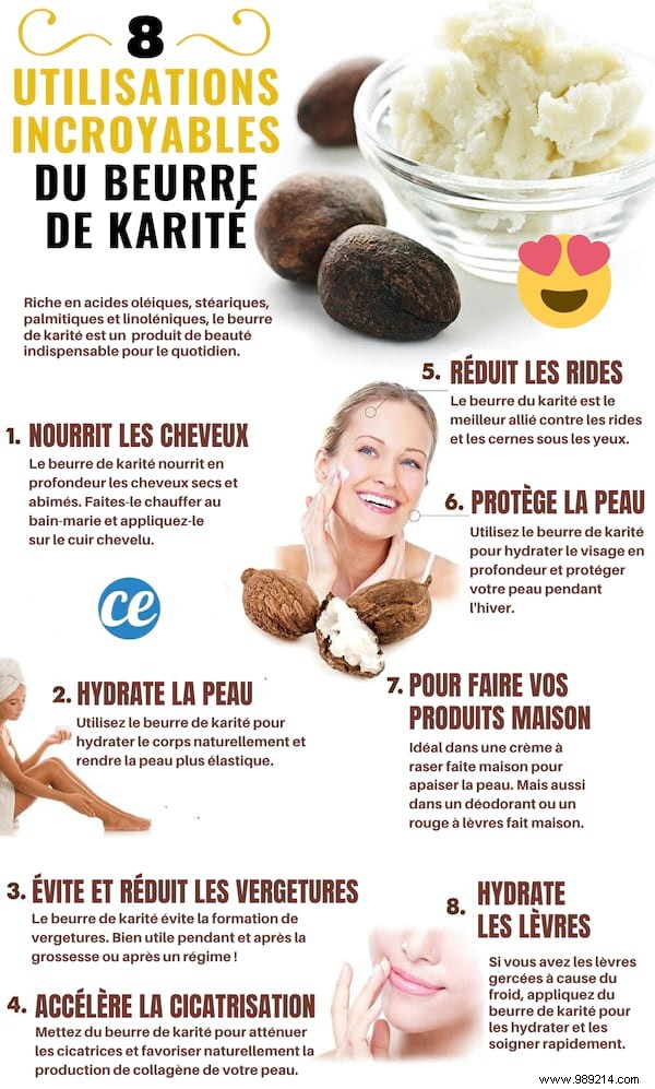 18 Proven Shea Butter Benefits for Skin, Hair, and Everyday Wellness