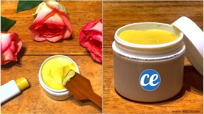 DIY Natural Lip Balm: Easy, Affordable Recipe for Healing Chapped Lips