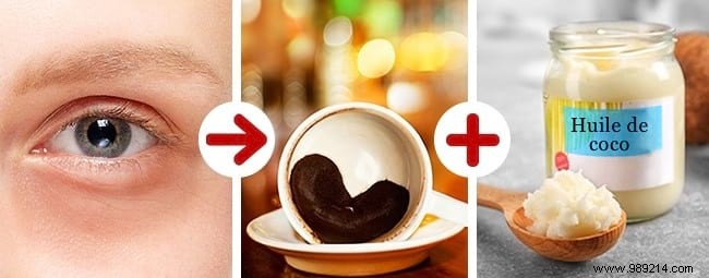 15 Proven Natural Beauty Hacks for Radiant Skin, Hair, and Nails