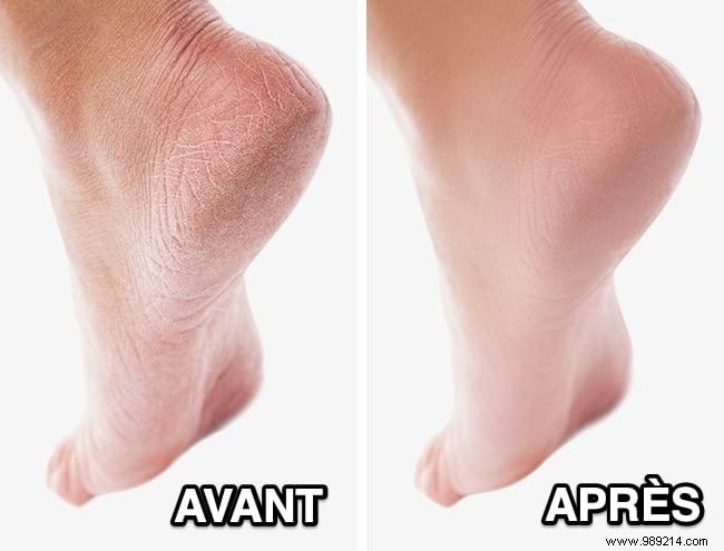 15 Proven Natural Beauty Hacks for Radiant Skin, Hair, and Nails