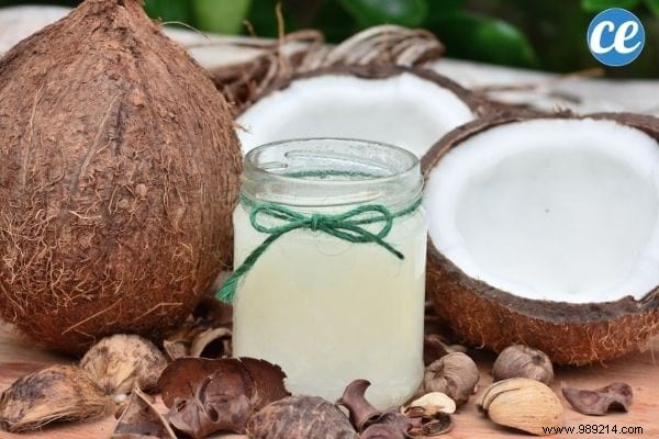 101 Everyday Uses for Coconut Oil: Kitchen, Beauty, Home Care & More