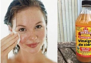 4 Proven Apple Cider Vinegar Remedies for Acne, Eczema, Cold Sores, and Itching