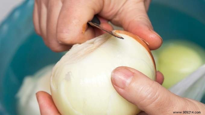 Proven Kitchen Hack: Peel Onions Without Tears Using Running Water