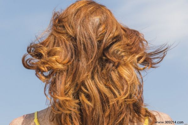 7 Practical Ways to Repurpose Onion Skins and Reduce Waste