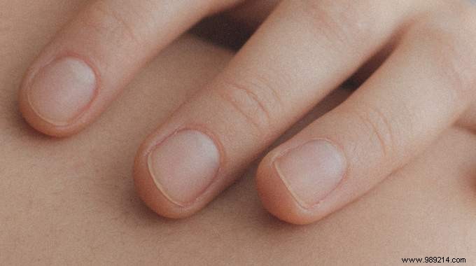 How to Identify Your Skin Type for Smarter Skincare Choices