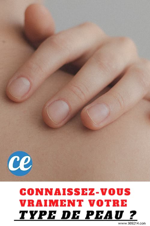 How to Identify Your Skin Type for Smarter Skincare Choices