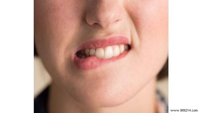 Pharmacist-Approved Green Clay Remedy for Fast Canker Sore Relief